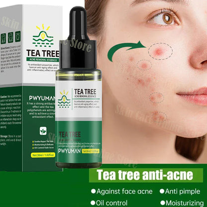 TEA TREE - Serum Acne Removal